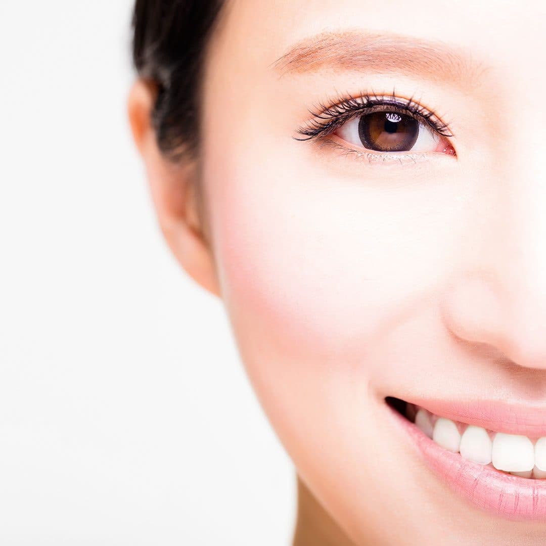 A defined upper eyelid crease of the kind double eyelid surgery creates