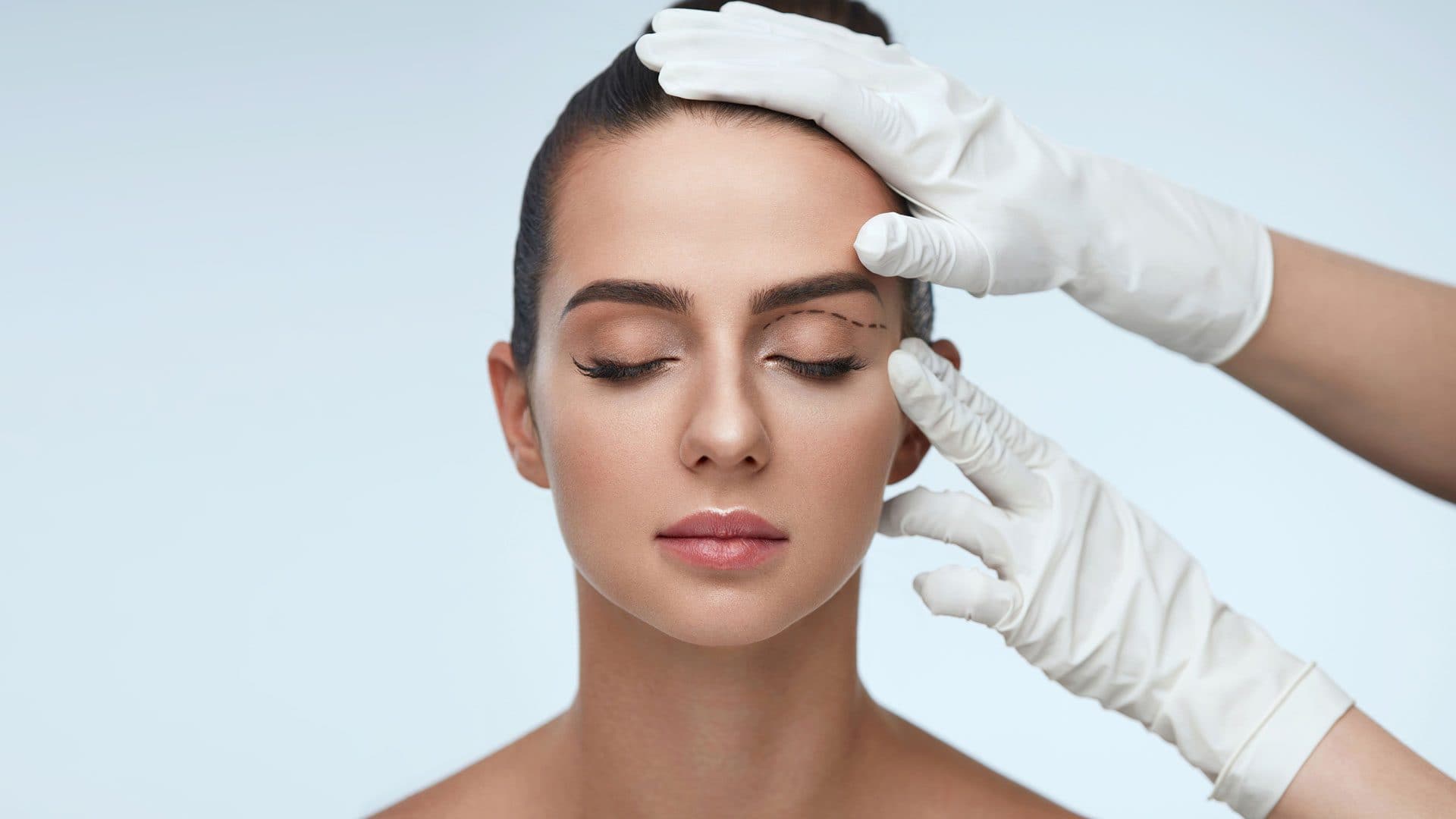 Gloved hands marking surgical guide lines along a patient's upper eyelid crease