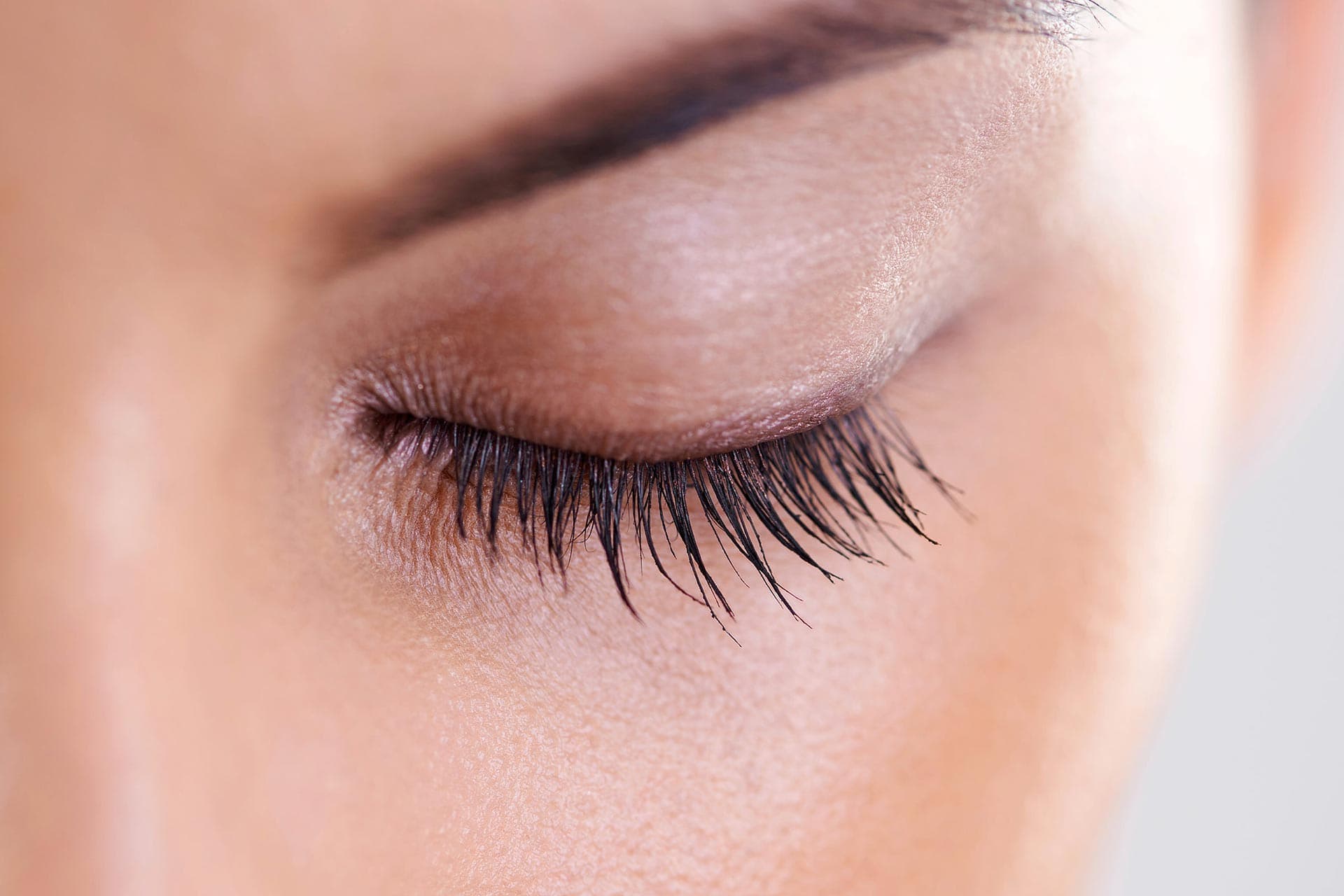 Ptosis surgery