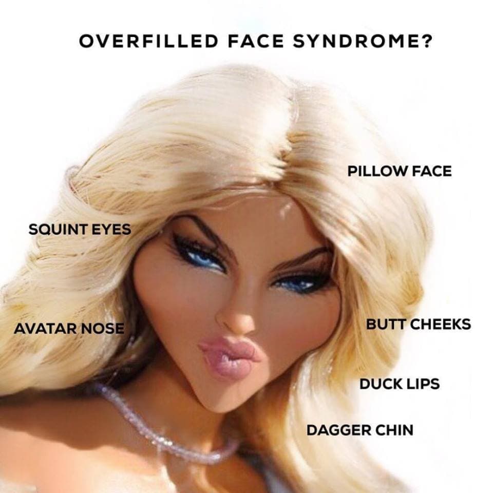 Facial Overfilled Syndrome: What It Is And How We Can Help You Treat It Safely