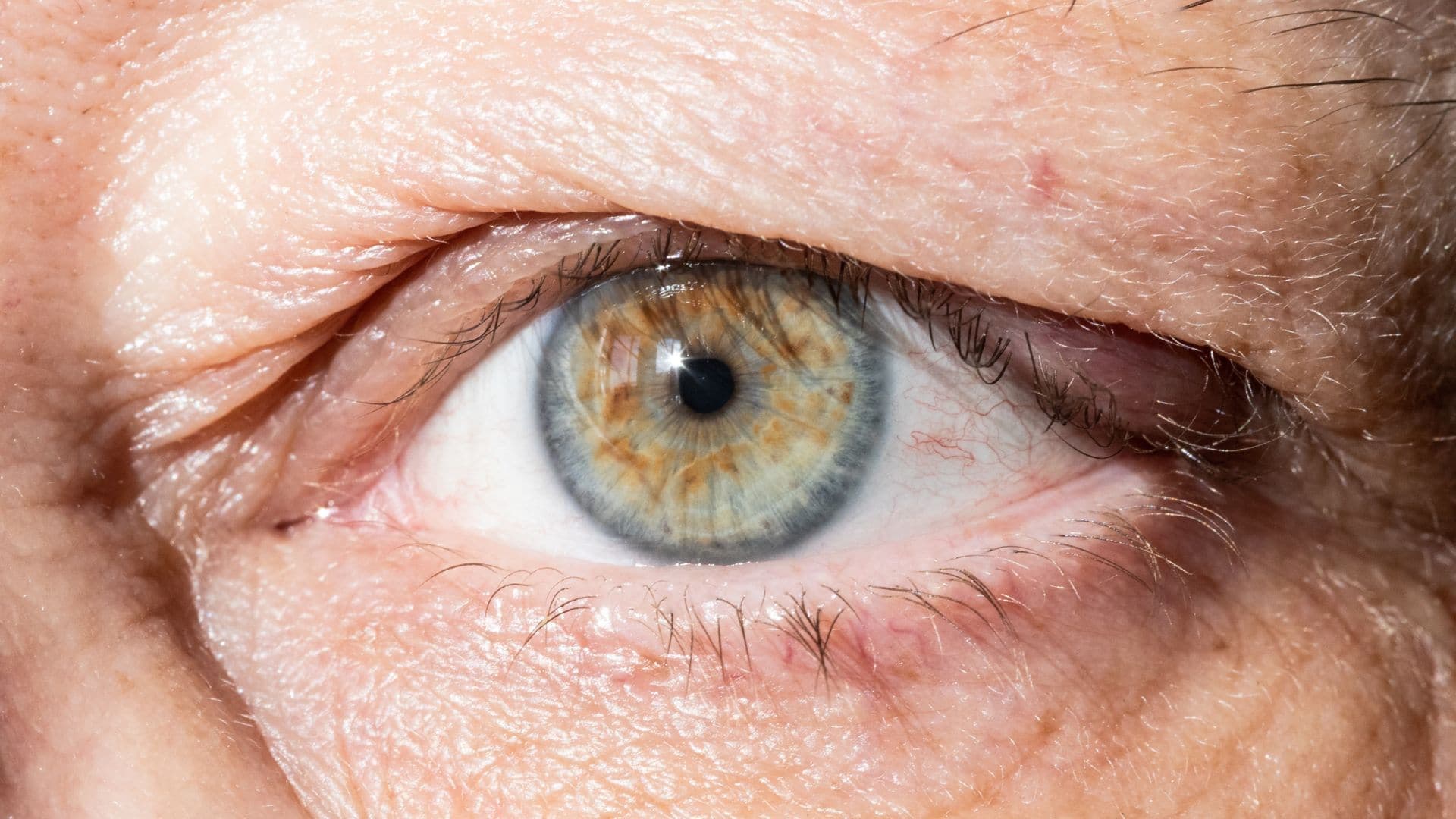 What Are Hooded Eyes? - Causes & Symptoms