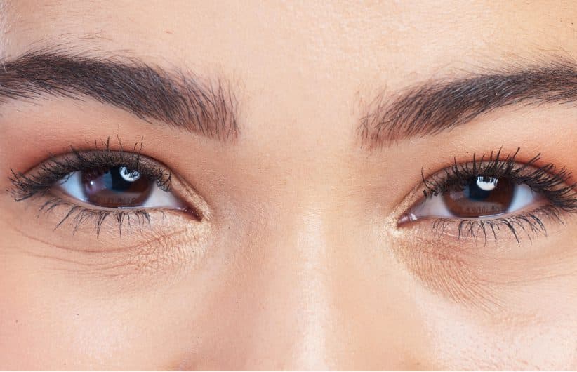 How Does Tear Trough Filler Procedure Work?