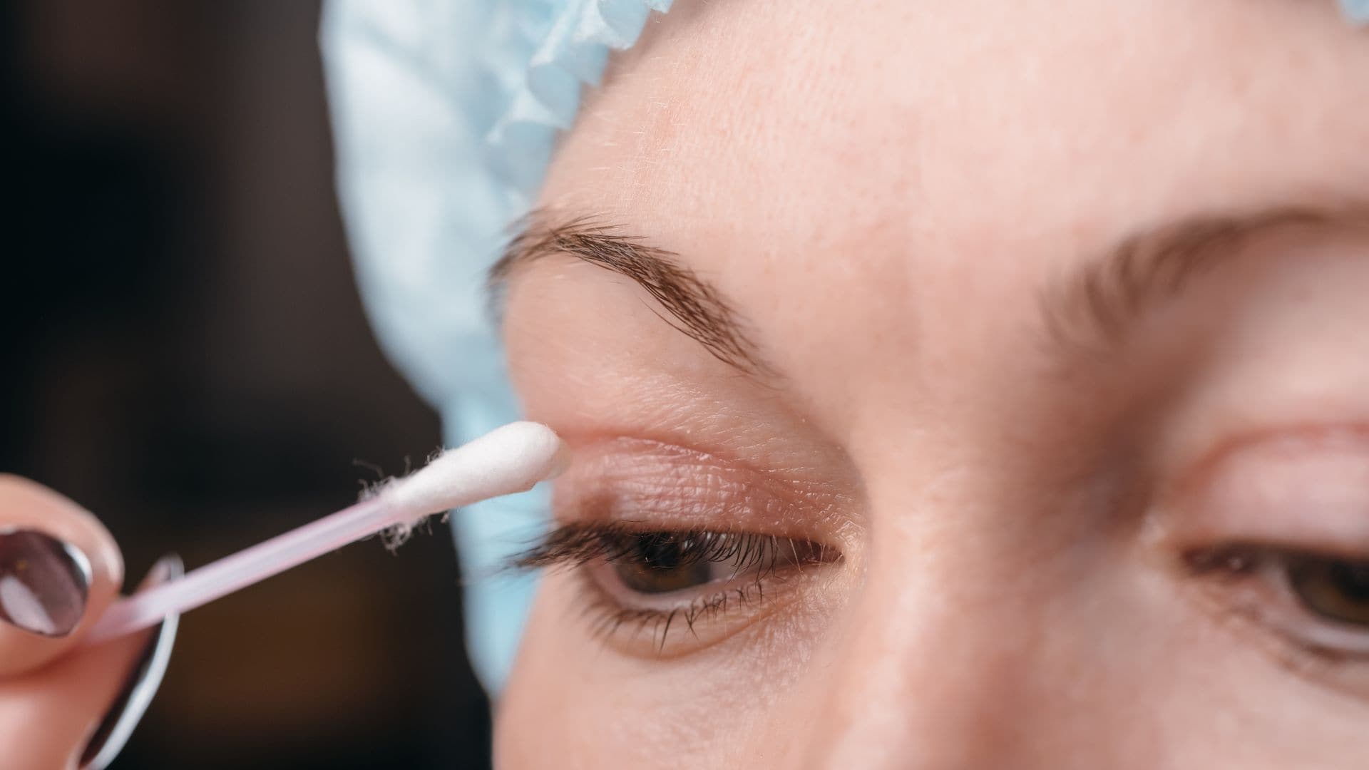 How To Minimise Blepharoplasty Scars?