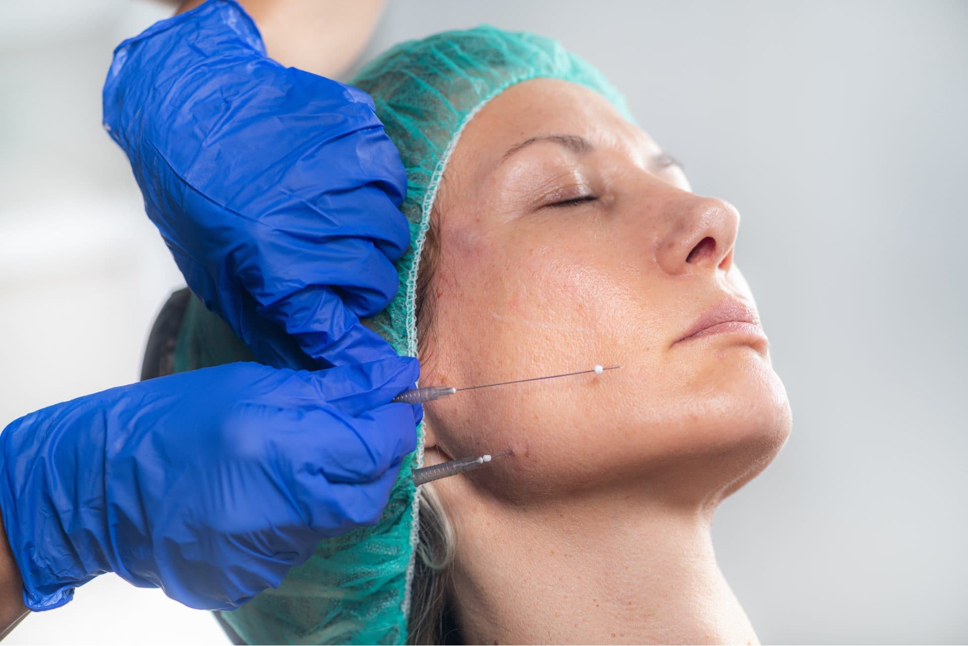 How Does Mid Facelift Procedure Work?