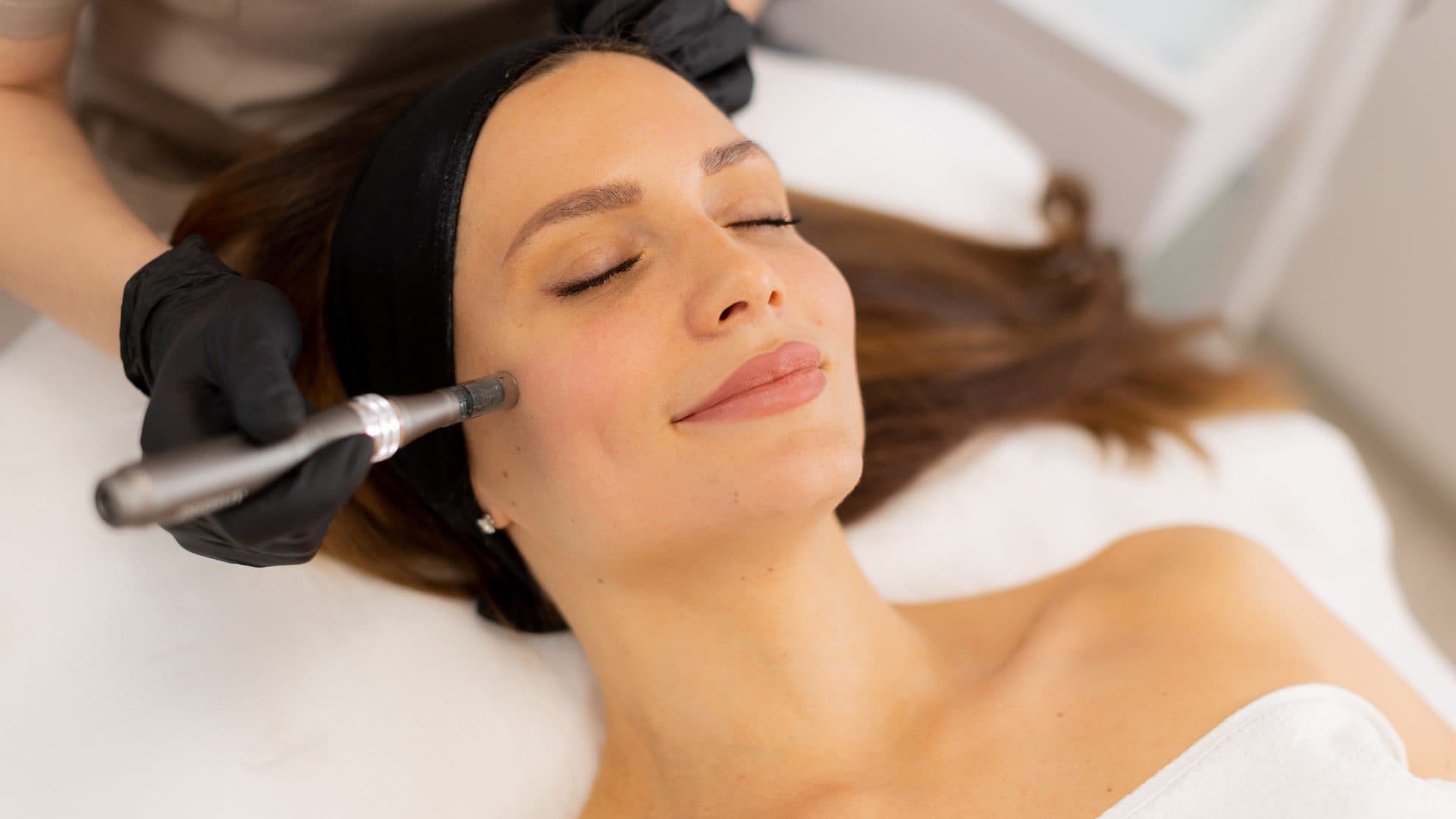 Benefits of Microneedling