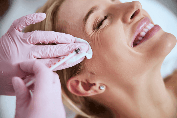 What is Crow's Feet?