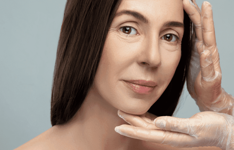 What are Eye Bags?