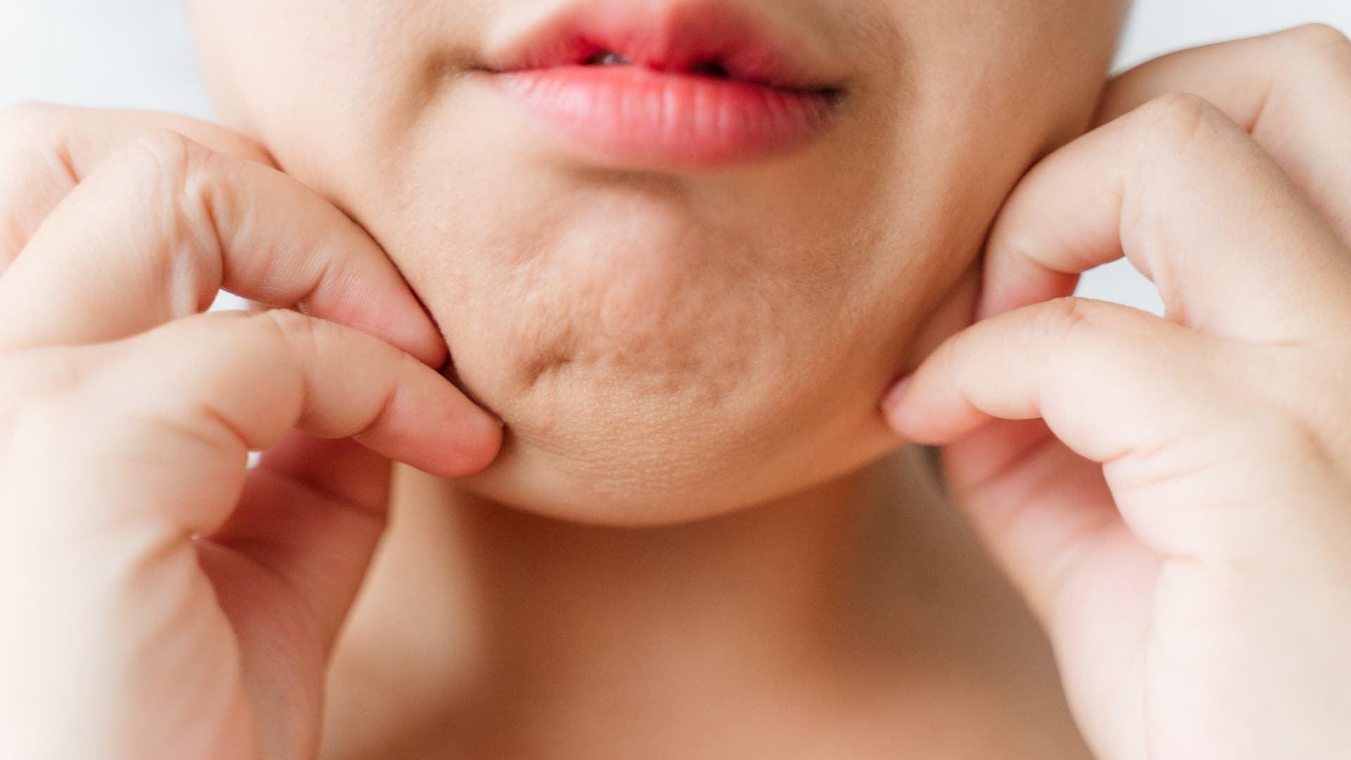 How to Get Rid of Double Chin?